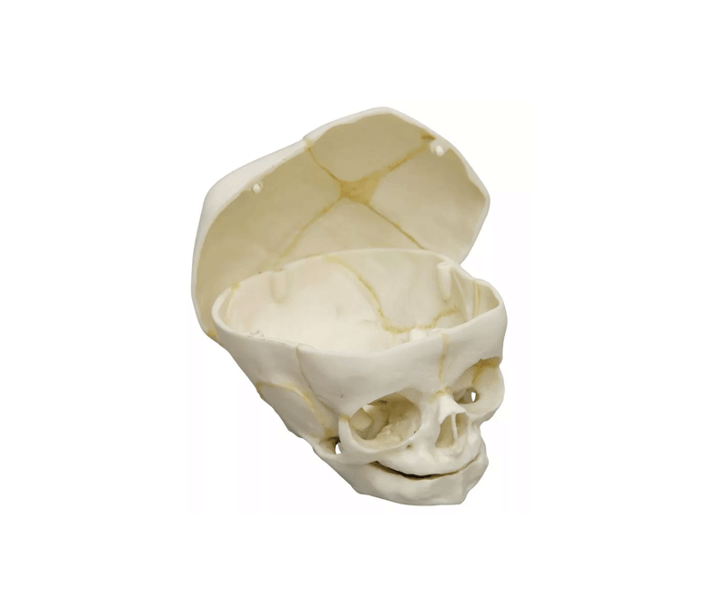 Fetusschädel, 40 Wochen, mit abnehmbarem Schädeldach – einzigartiges Lehrmodell mit Einblick in das Endokranium - Erler - Zimmer