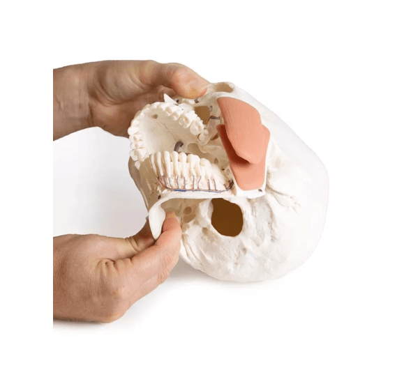 Schädelmodell für Zahnmedizin mit CMD - Syndrom, 8 - teilig – spezialisiertes Lehrmodell zur craniomandibulären Dysfunktion - Erler - Zimmer