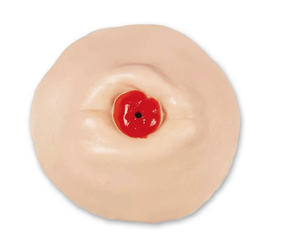 Stoma Trainer - Erler - Zimmer