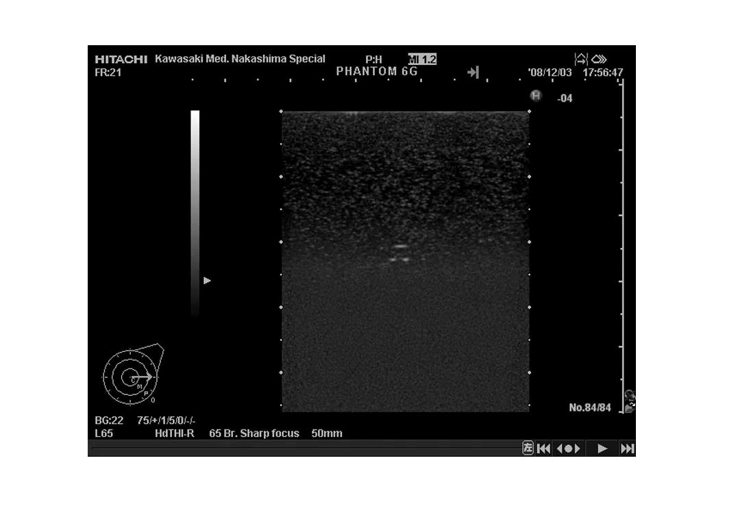 Brust - Phantom - Erler - Zimmer