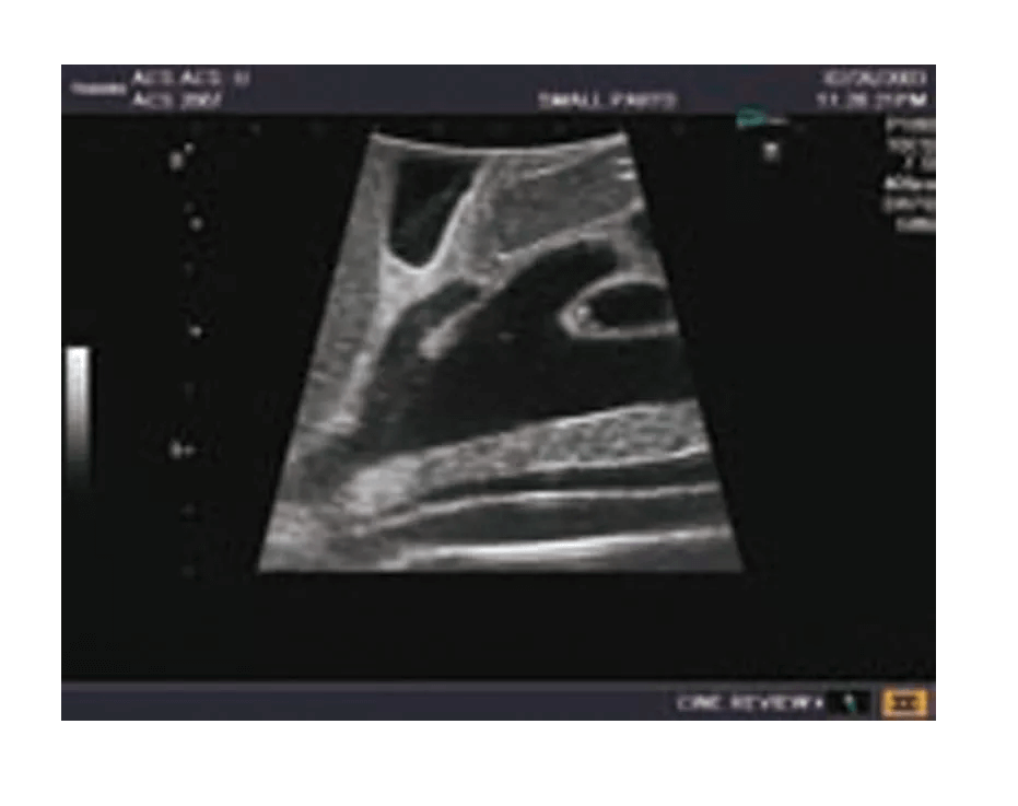 Ultraschall - Modell für Sonografie - Erler - Zimmer