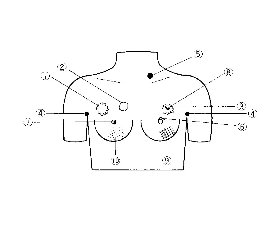 Brustkrebs - Tastmodell - Erler - Zimmer