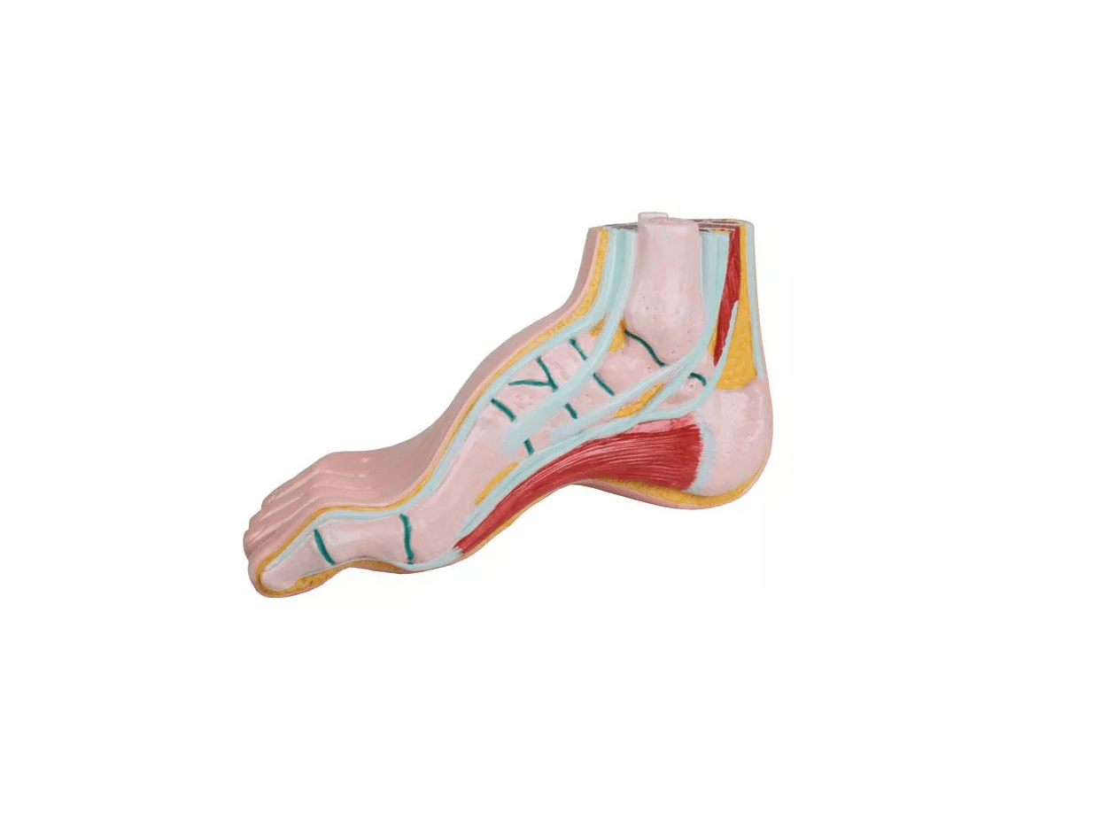 Hohlfuß, pes cavus - Erler - Zimmer