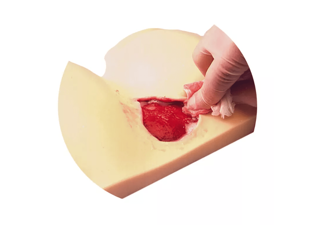 Dekubituspflege - Simulator - Erler - Zimmer