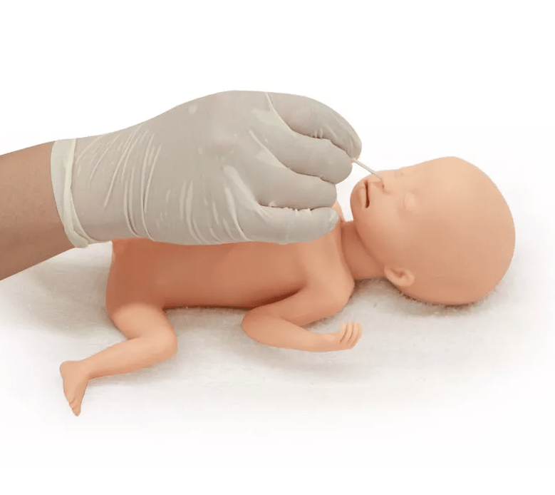 Frühgeborenes mit extrem niedrigem Geburtsgewicht (ELBW) - Erler - Zimmer