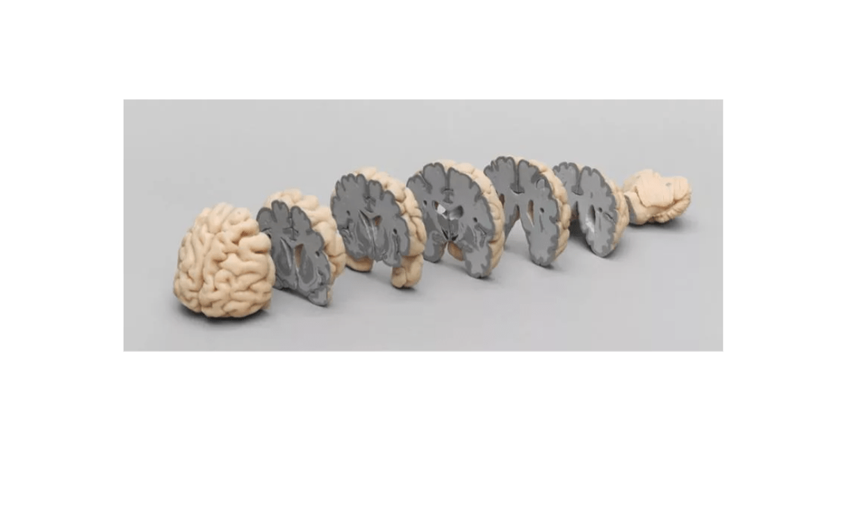 Menschliches Gehirn in Frontalschnitten - Erler - Zimmer