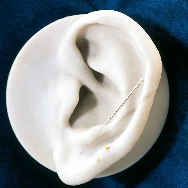 Akupunkturnadeln Silbergriff - Servoprax