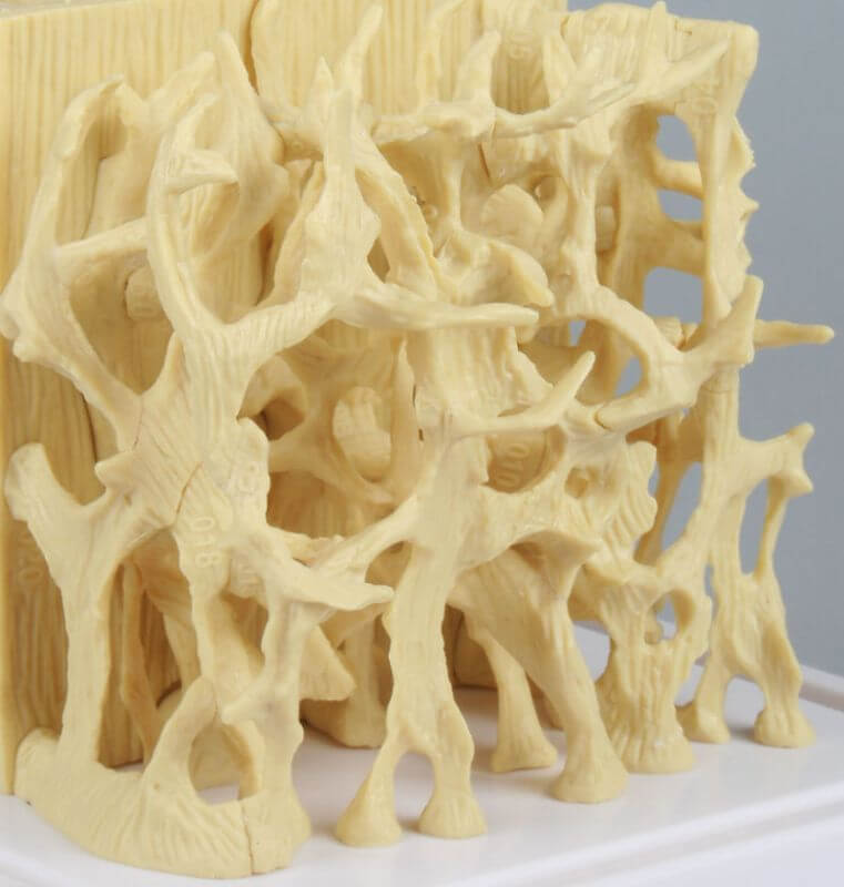 Vergleichsmodell gesunde / osteoporotische Knochenstruktur – Starke Vergrößerung zur anschaulichen Darstellung - Erler - Zimmer