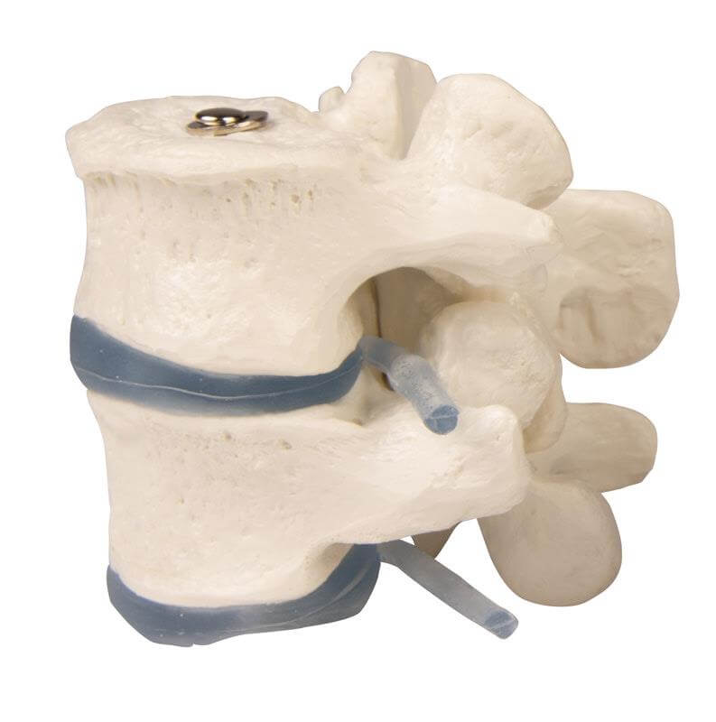 2 Lendenwirbel – elastisch montiert und zerlegbar - Erler - Zimmer