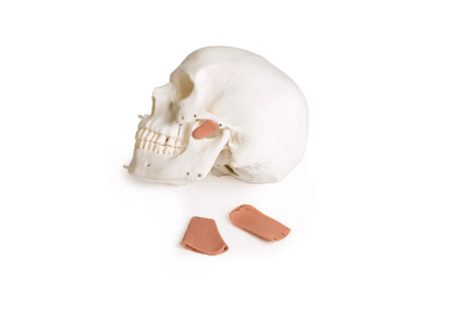 Schädelmodell für Zahnmedizin mit CMD - Syndrom, 8 - teilig – spezialisiertes Lehrmodell zur craniomandibulären Dysfunktion - Erler - Zimmer