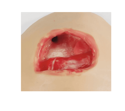 Übungsmodelle für die Vakuum - Wundtherapie - Erler - Zimmer