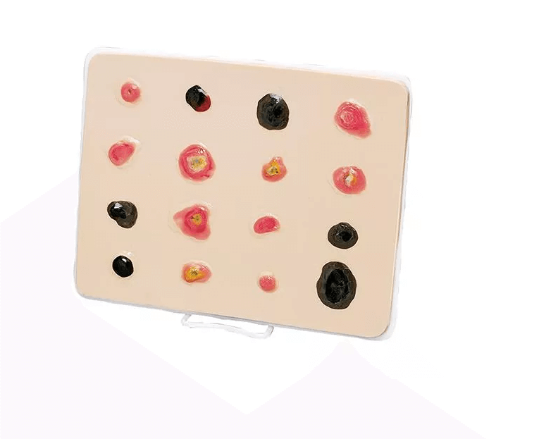 Übungsmodell Weißer Hautkrebs – vergrößert - Erler - Zimmer