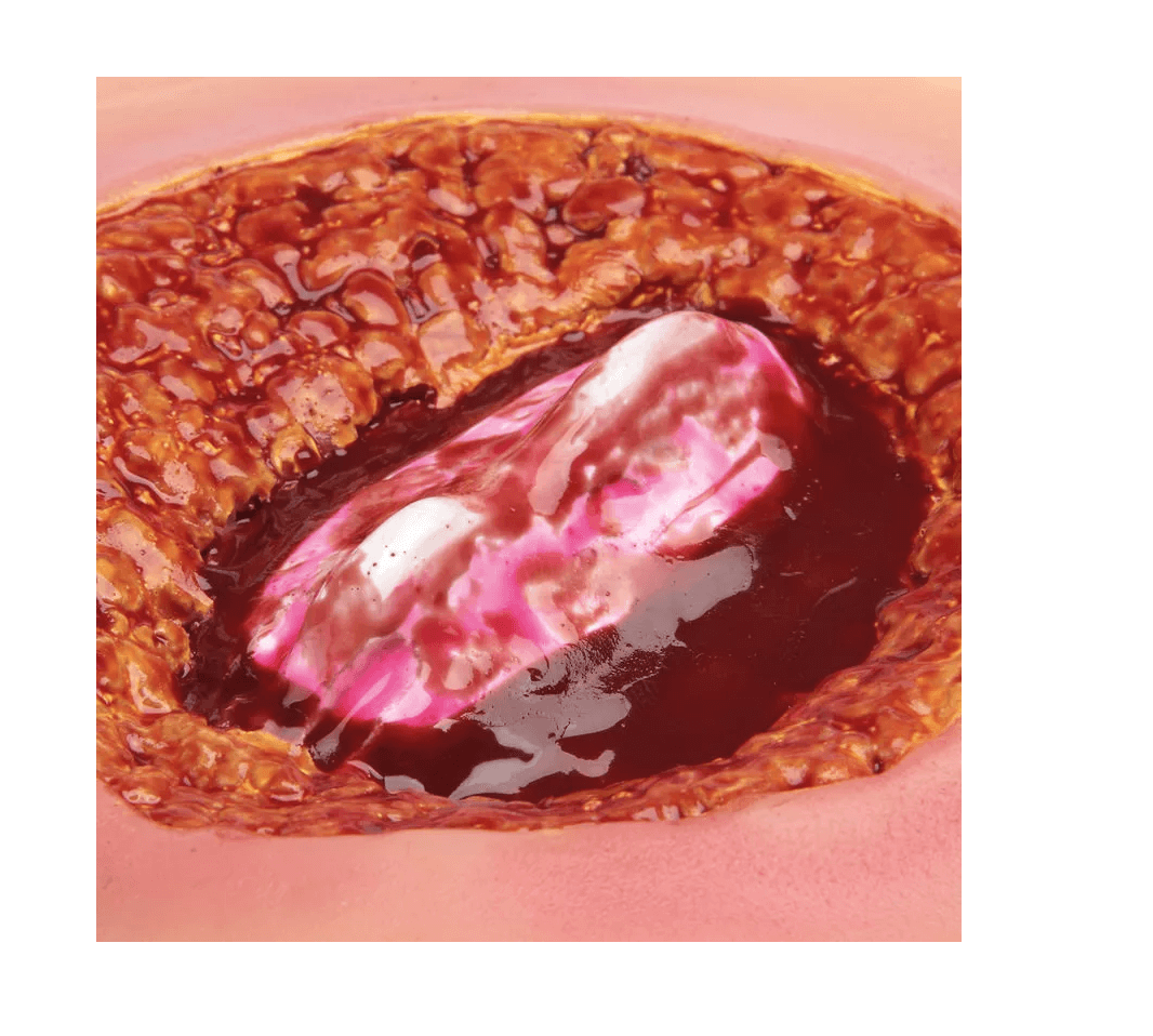 Krankenpflege - Moulagen - Kit - Erler - Zimmer