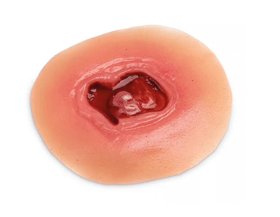 Krankenpflege - Moulagen - Kit - Erler - Zimmer