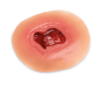 Krankenpflege - Moulagen - Kit - Erler - Zimmer