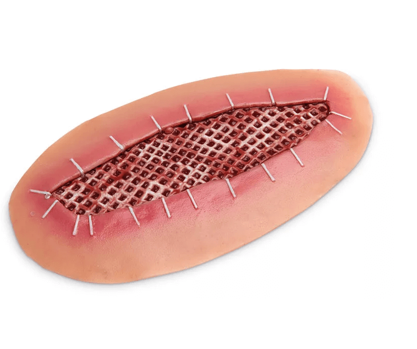 Krankenpflege - Moulagen - Kit - Erler - Zimmer