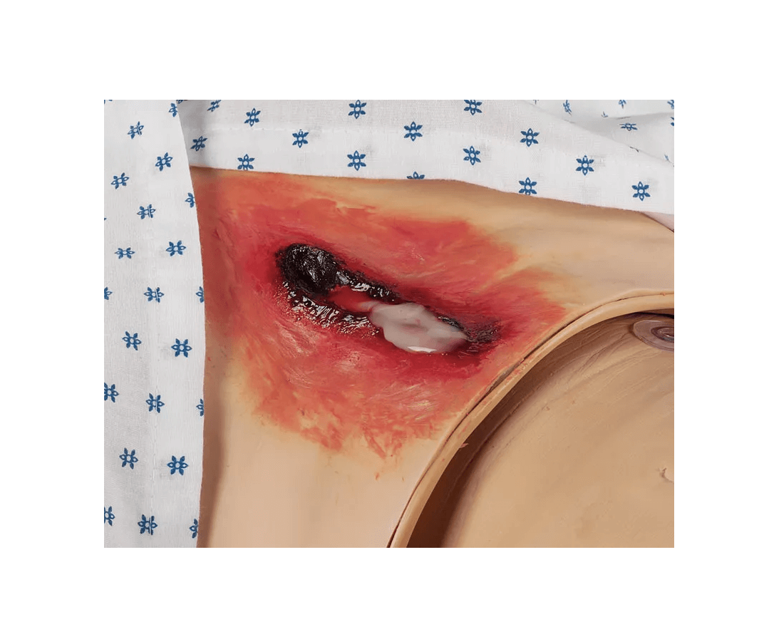 Pflege - Wunden - Simulations - Kit Ultra - Erler - Zimmer