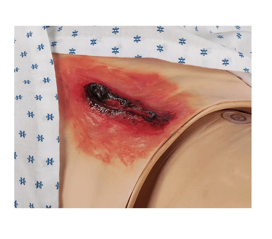 Pflege - Wunden - Simulations - Kit Ultra - Erler - Zimmer