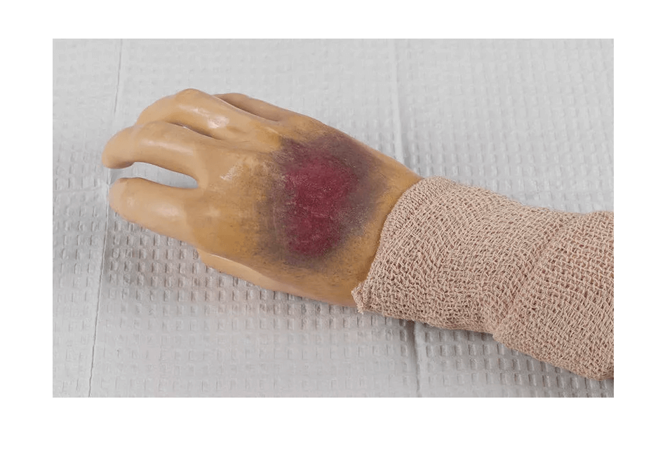 Pflege - Wunden - Simulations - Kit Ultra - Erler - Zimmer