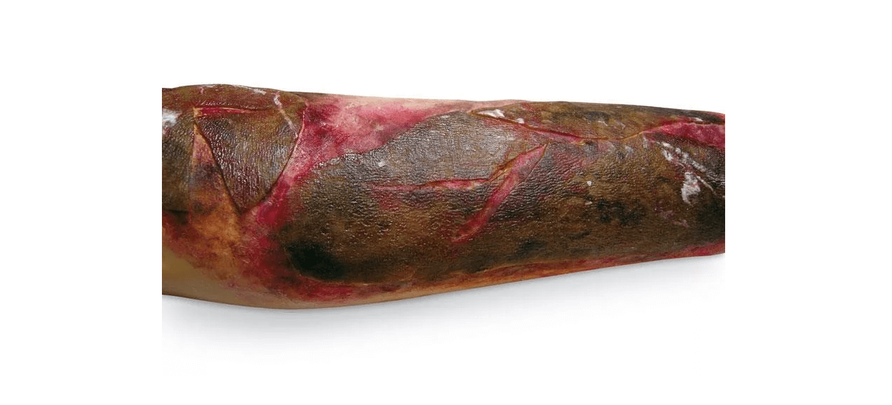 Simulierte Verbrennungen - Erler - Zimmer