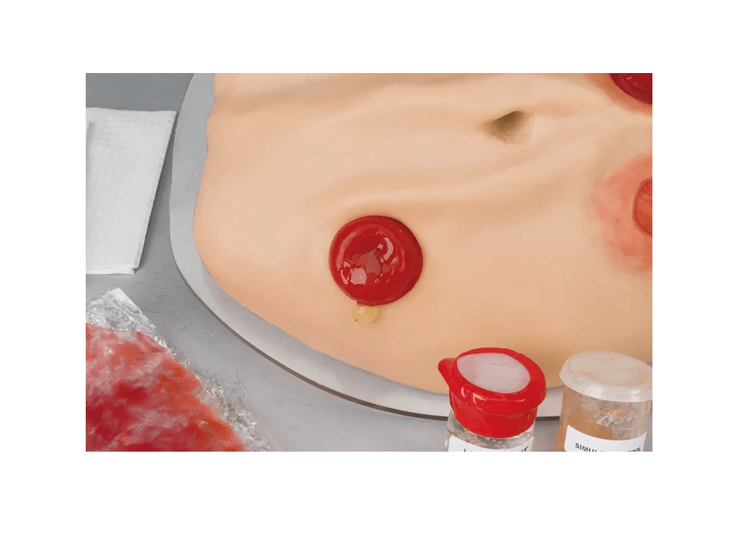Kompletter Stoma - Simulator - Erler - Zimmer