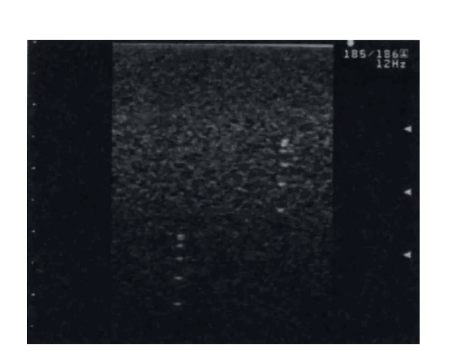 Vielzweck - Phantom - Erler - Zimmer