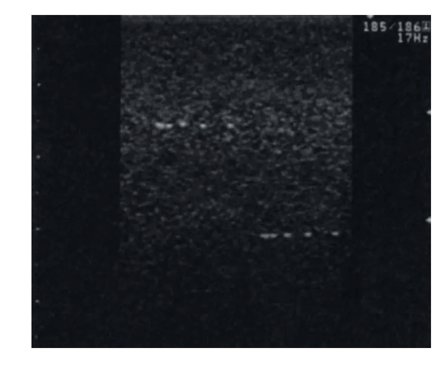 Vielzweck - Phantom - Erler - Zimmer