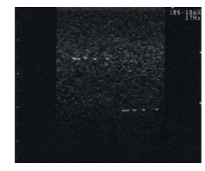 Vielzweck - Phantom - Erler - Zimmer