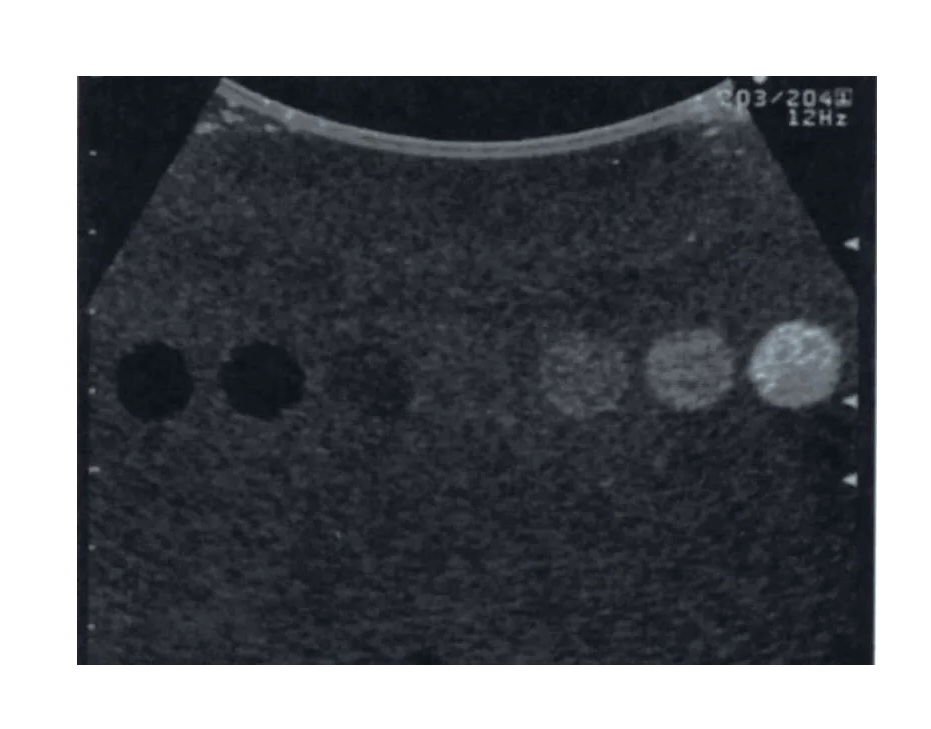 Vielzweck - Phantom - Erler - Zimmer