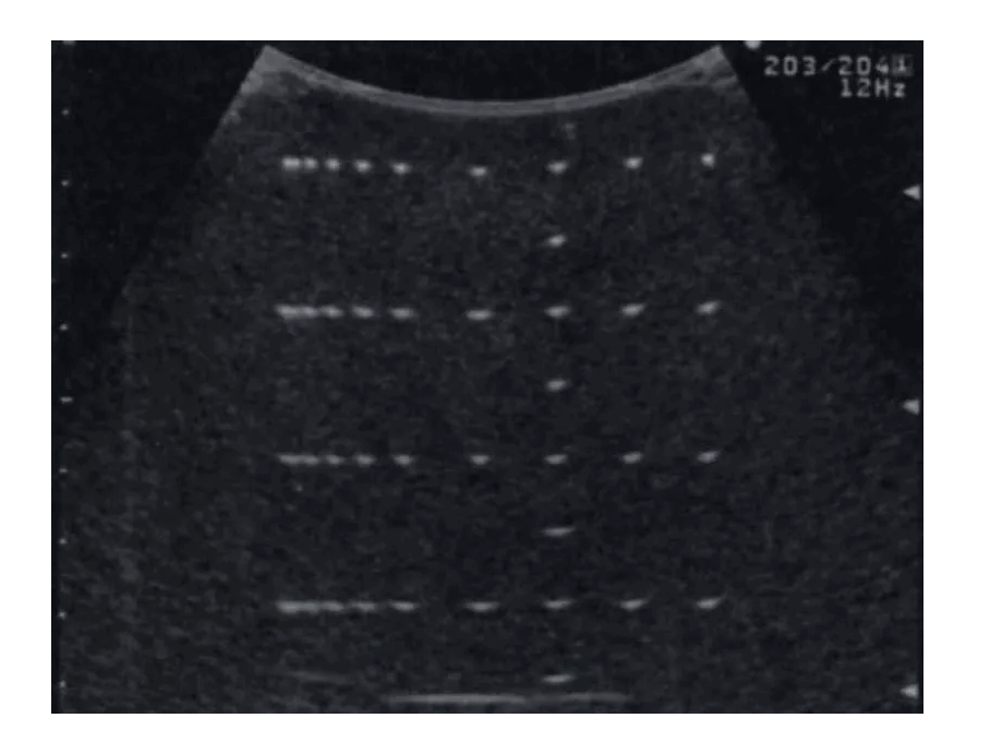 Vielzweck - Phantom - Erler - Zimmer
