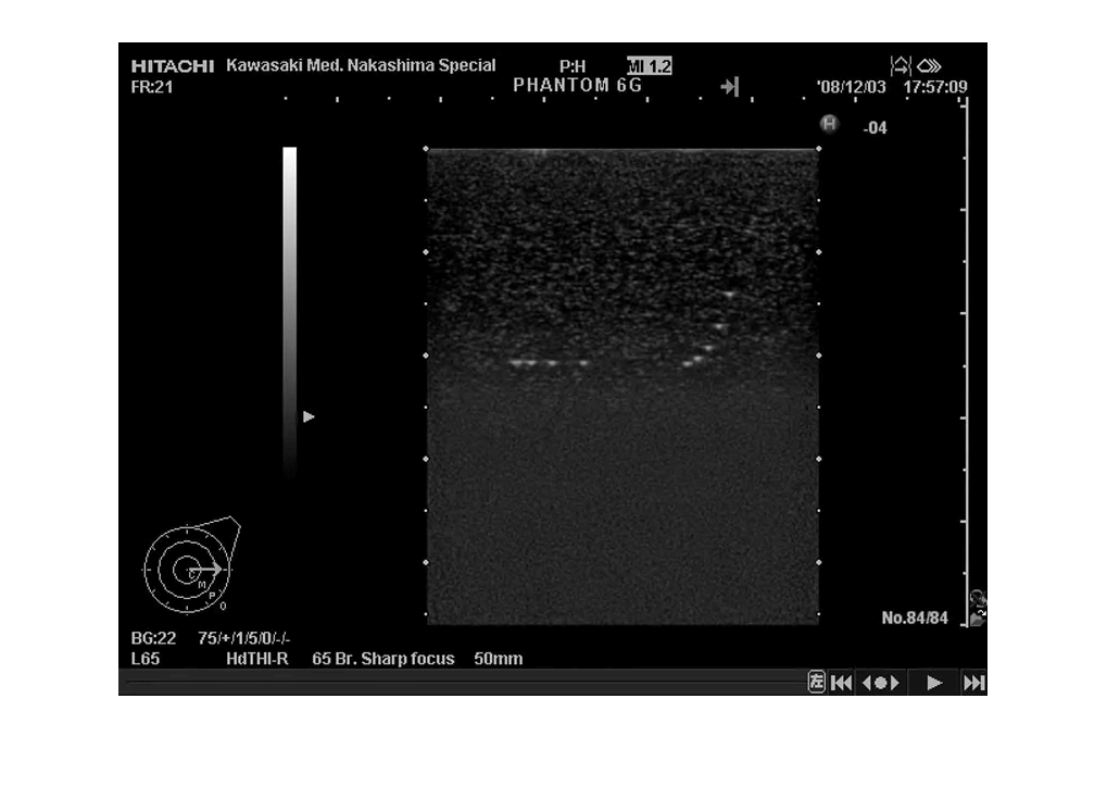 Brust - Phantom - Erler - Zimmer