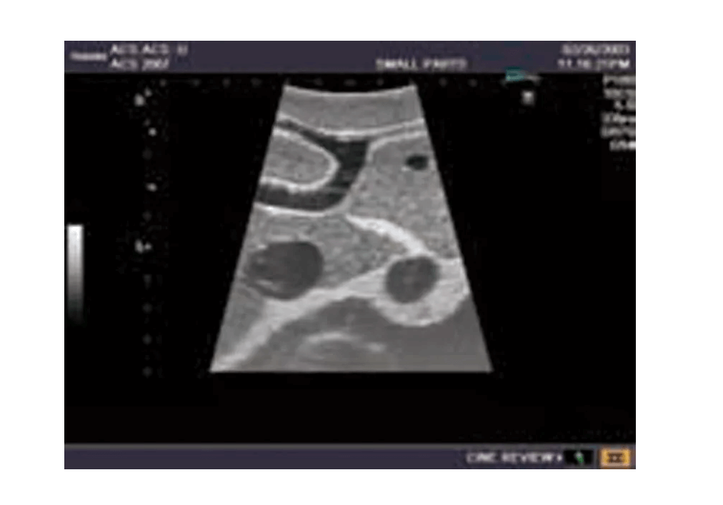 Ultraschall - Modell für Sonografie - Erler - Zimmer