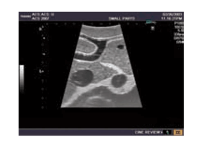 Ultraschall - Modell für Sonografie - Erler - Zimmer