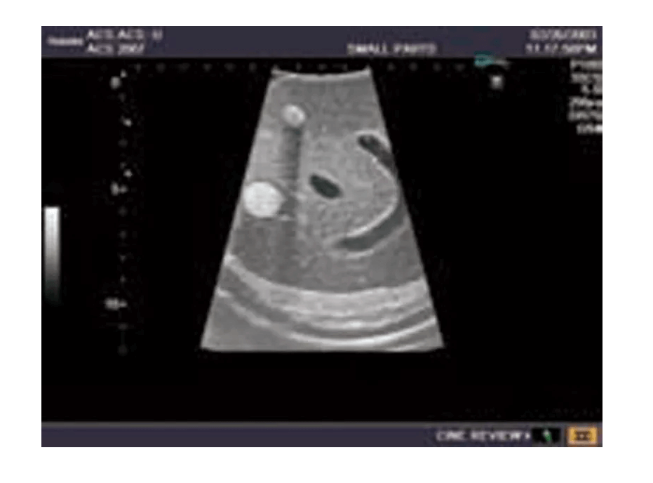 Ultraschall - Modell für Sonografie - Erler - Zimmer