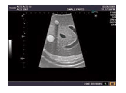 Ultraschall - Modell für Sonografie - Erler - Zimmer