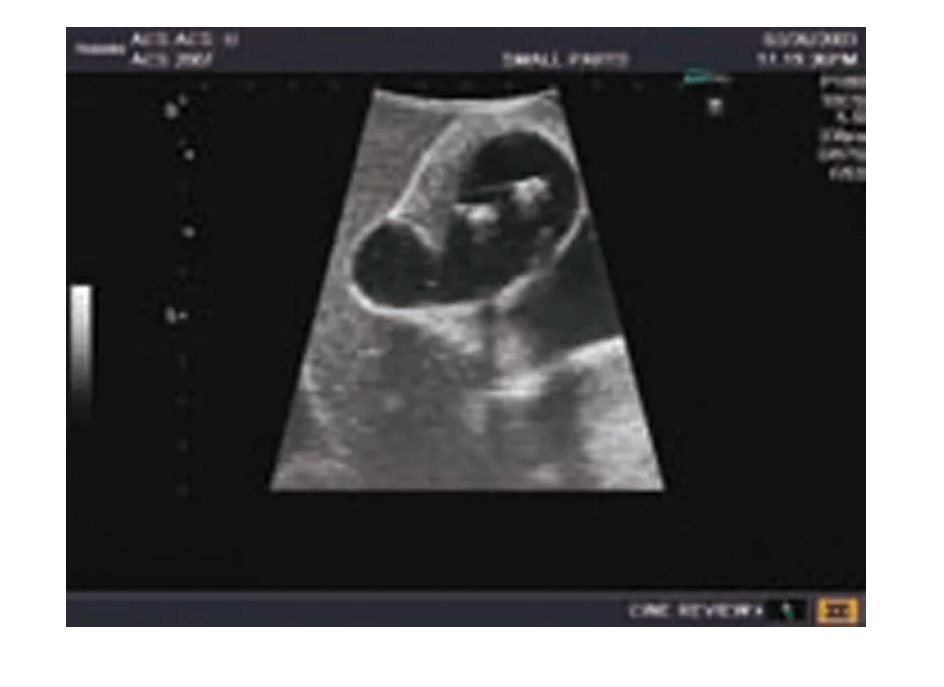 Ultraschall - Modell für Sonografie - Erler - Zimmer