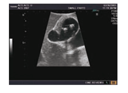 Ultraschall - Modell für Sonografie - Erler - Zimmer