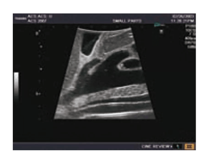 Ultraschall - Modell für Sonografie - Erler - Zimmer