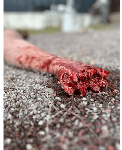 Tourniquet Trainer - Blutungsarm - Erler - Zimmer