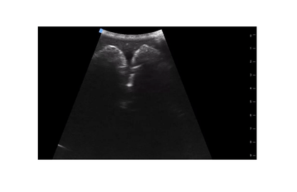 SonoEZ Ultraschalltrainer "Harnblase" - Erler - Zimmer