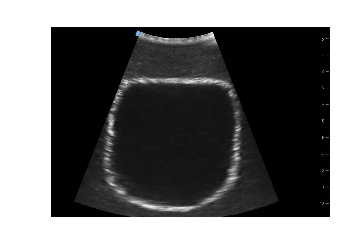 SonoEZ Ultraschalltrainer "Harnblase" - Erler - Zimmer