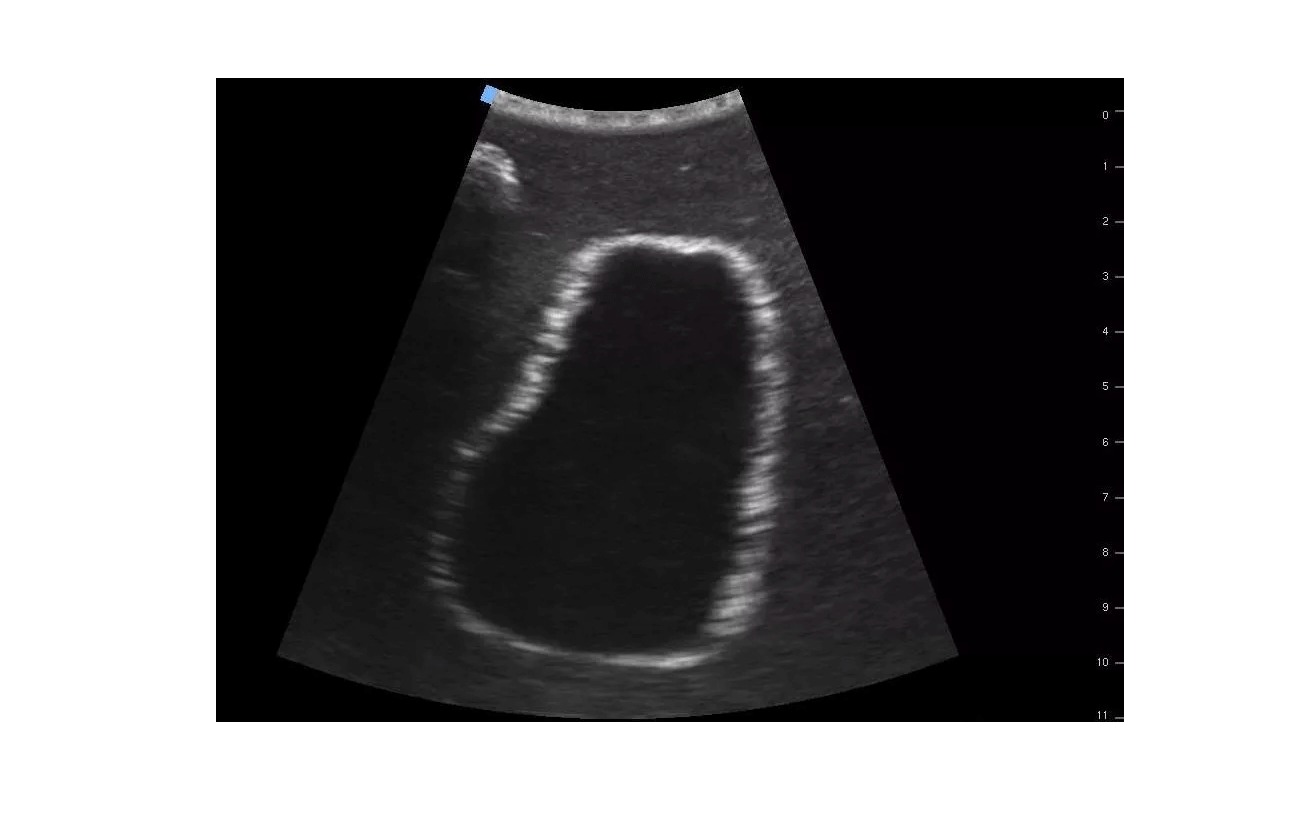 SonoEZ Ultraschalltrainer "Harnblase" - Erler - Zimmer