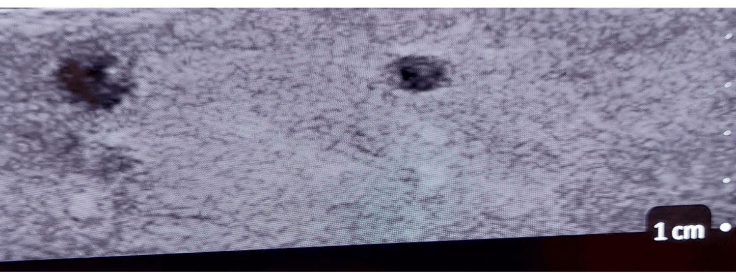 Ultraschall – Regionalanästhesie - Simulator - Erler - Zimmer