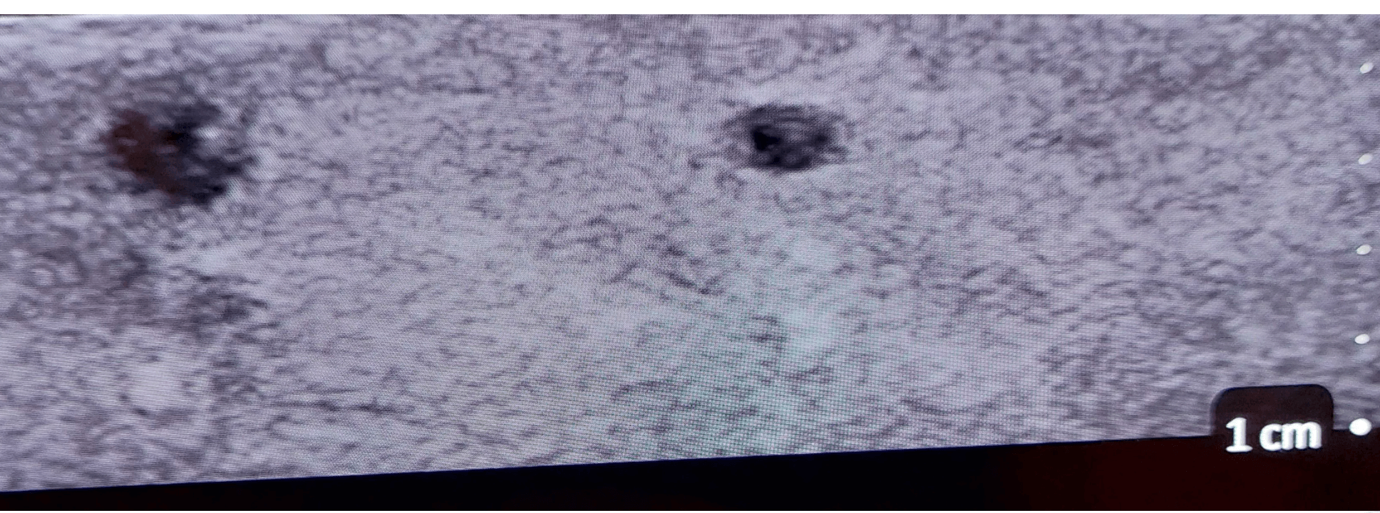 Ultraschall – Regionalanästhesie - Simulator - Erler - Zimmer