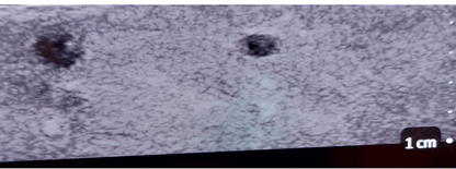 Ultraschall – Regionalanästhesie - Simulator - Erler - Zimmer