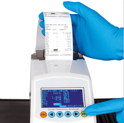 Reader Auswertegerät für Urin - Teststreifen - Servotest