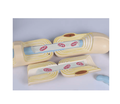 Neuron, 3000 - fache Größe, 2 - teilig - Erler - Zimmer