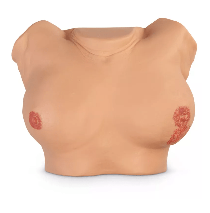 Brustuntersuchungssimulator, erweiterte Version - Erler - Zimmer