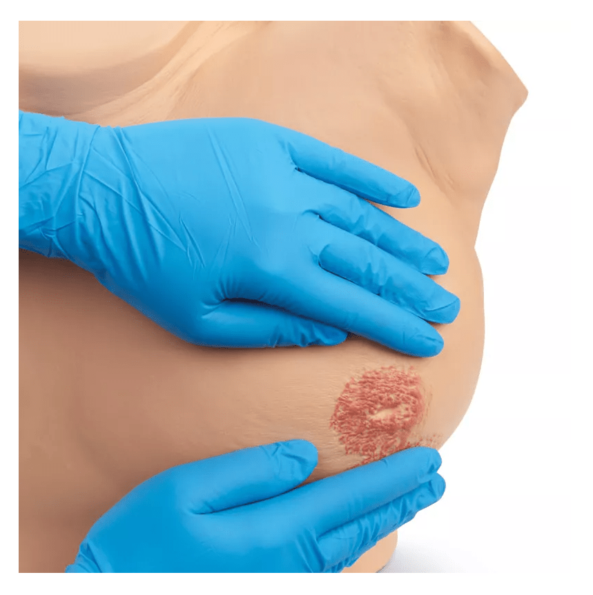 Brustuntersuchungssimulator, erweiterte Version - Erler - Zimmer