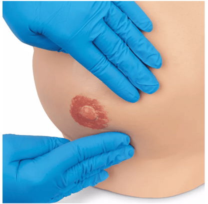 Brustuntersuchungssimulator, erweiterte Version - Erler - Zimmer